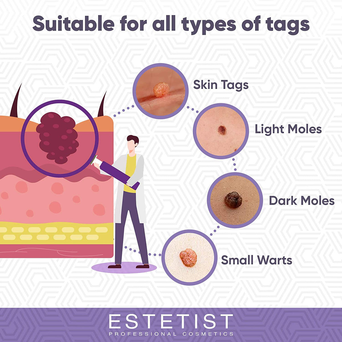 Tag Removal Patches - Wart and Acne Remover freeshipping - ESTETIST LLC